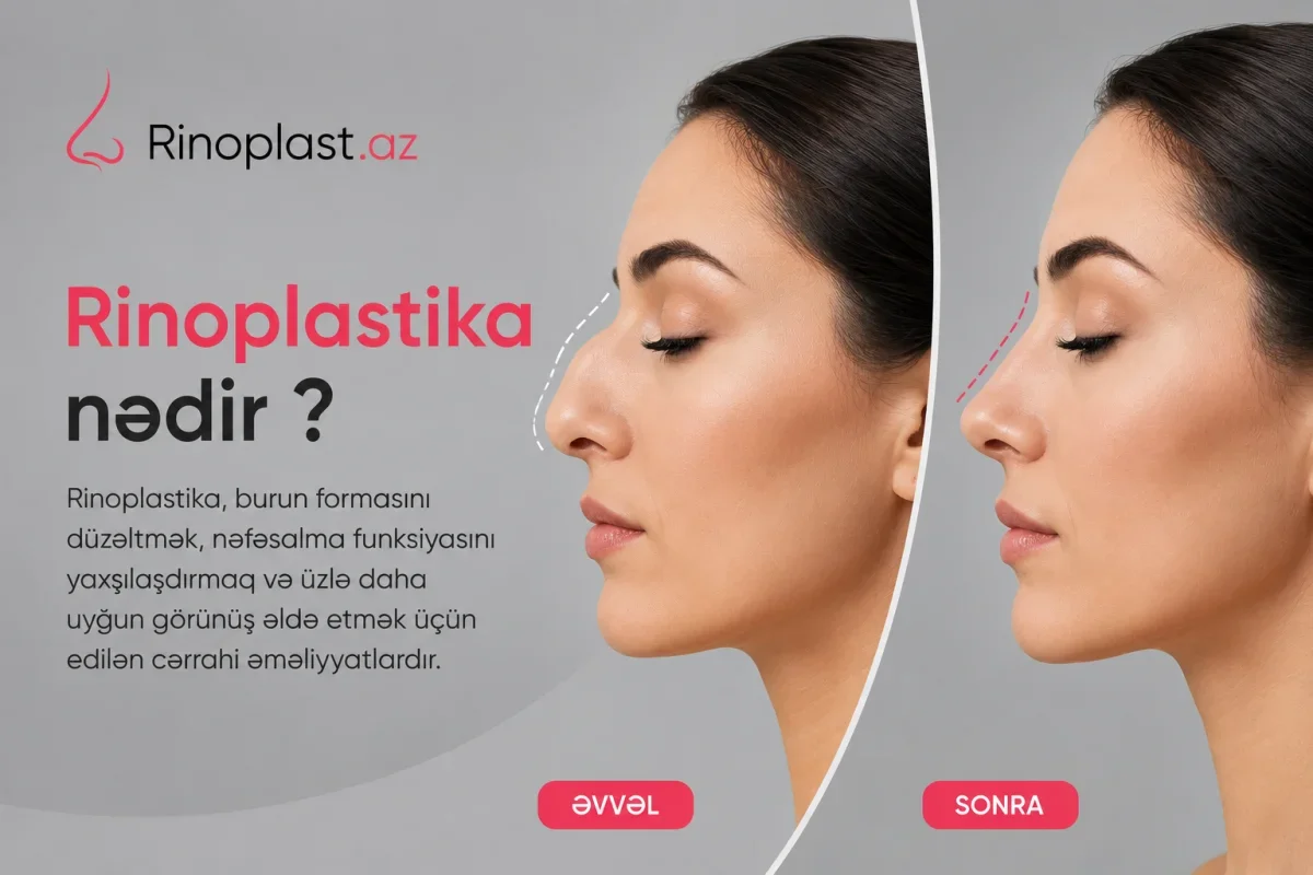 Rinoplastika nedir?