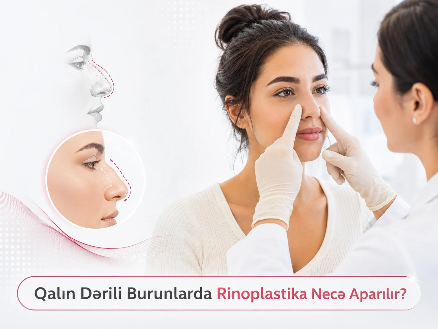 Qalin Derili Burunlarda Rinoplastika Nece Aparilir?