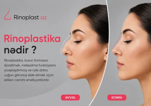 Rinoplastika nedir?