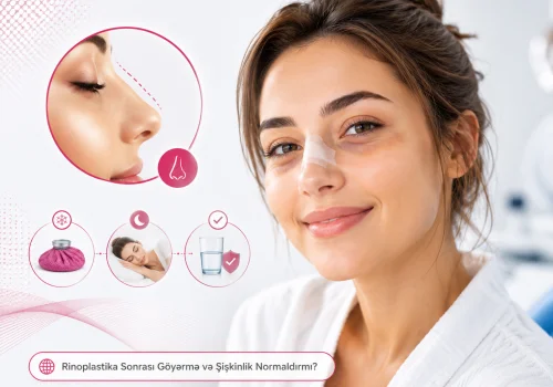 Rinoplastika Sonrasi Goyerme ve Siskinlik Normaldirmi?